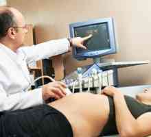 Molarna trudnoća za vrijeme trudnoće, znakovima, simptomima, uzrocima, liječenje