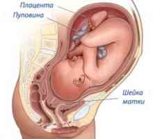 Cerviks prije rođenja, simptomi, znakovi