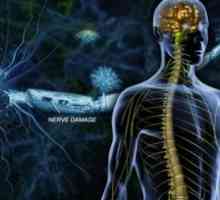 Multipla skleroza: Simptomi, liječenje, simptomi, uzroci, dijagnoza, prevencija