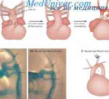 Razvoj arterijski krvožilni sustav. Stupnjevi formiranja fetusa aortu