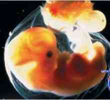 Refleksi embrij. Malog mozga i njegove funkcije u fetus