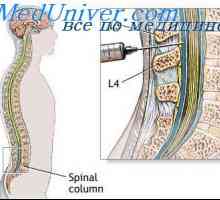 Cerebrospinalnog sustav fluida. Funkcije likvora