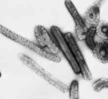 Obitelj arboviruses, arenavirusi i filoviruse