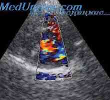 Jezgra pretvarača. ultrazvučni polje