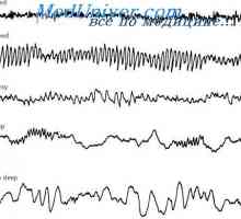 Moždani valovi i razine aktivnosti mozga. Elektroencefalogram (EEG) spavanja