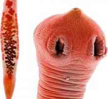Simptomi crve (helminta) i žučni kanali