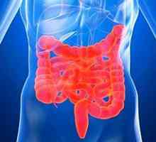 Simptomi sindrom iritabilnog crijeva (IBS)