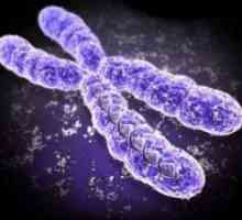 Sindrom fragilnog X kromosoma u djece