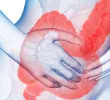 Sindroma iritabilnog crijeva u trudnoći