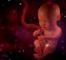 Sindrom retardacija rasta fetalnog