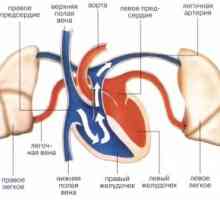 Sustavna embolija: uzroci, simptomi, znakovi, liječenje