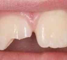 Oštećene i rastrgan zube