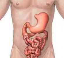 Spastički kolitis debelog crijeva