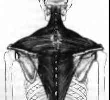 Bol u leđima uzrokovane trapezni mišić