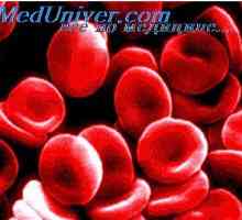 Opasan anemija. formiranje hemoglobina