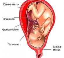 Krvarenje u prvom tromjesečju trudnoće. Zašto se pojavljuju i da li je to normalno?