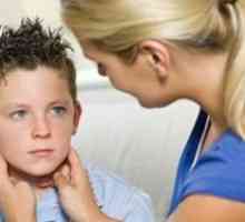 Zaušnjaci bolest: simptomi, posljedice liječenja, simptomi, uzroci