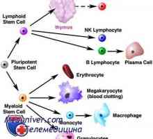 Transplantacija matičnih stanica i Hodgkin limfoma (Hodgkinova bolest)