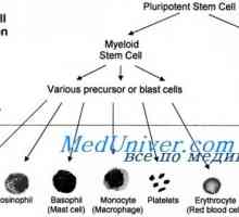 Transplantacija matičnih stanica u anemija srpastih stanica, Diamond Black sindrom ventilator