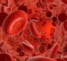 Trombocitopenija: liječenje, uzroci, simptomi, znakovi