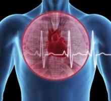 Plućna embolija i akutno zatajenje srca