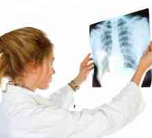 Tuberkuloza za periferni limfni čvorovi