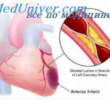 Unutarnje karotidne arterije embrija. Luk aorte i plućne arterije fetusa