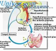 Prenatalni toksoplazmoza. Učinak valproinske kiseline na fetus