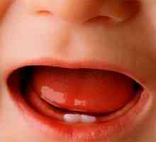 Visoka temperatura i proljev, a dobivanje zuba u djece