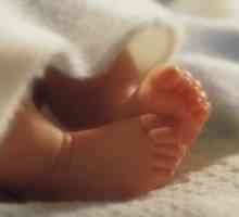 Bolesti djece odmah nakon rođenja