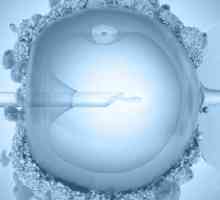 Zatvor nakon prijenosa embrija (IVF)