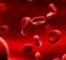 Zhelezorefrakternaya anemija