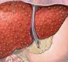 Masnih infiltracija gušterače kod pankreatitisa i pretilosti