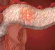 Masno gušterače (pankreasa nekroza)