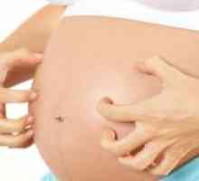 Svrbež kože tijekom trudnoće u ranim i kasnim fazama: uzroci, liječenje