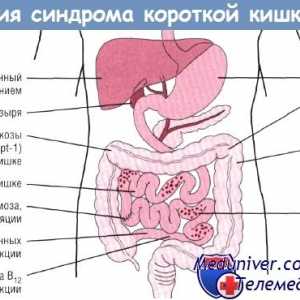 Učinak sindroma kratkog crijeva (ZSO) na gastrointestinalni trakt