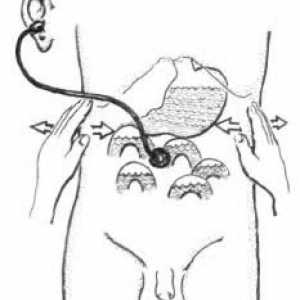 Supravaginalnu amputacija tijela maternice