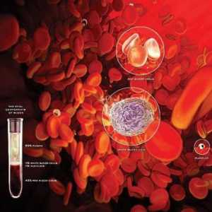 Aplastična anemija: liječenje, simptomi, uzroci, dijagnoza