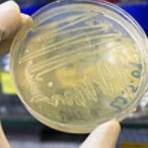 Biokemijska analiza fekalne bakterijske zaraštavanja