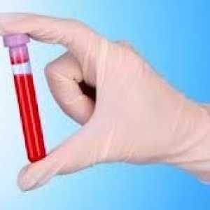 Krv biokemija gušterače s pankreatitisom
