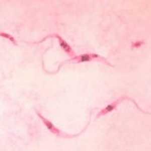 Chagas bolest: simptomi, tretman, uzroci, dijagnoza, uzroci