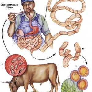 Goveđi (naoružani) parazit goveđi parazit infekcija u ljudi