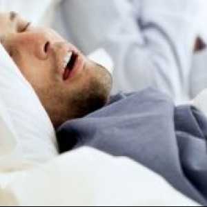 Središnja apneja za vrijeme spavanja: liječenje, simptomi, uzroci, dijagnoza