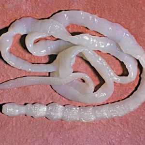 Crv parazit (trakavice) u odraslih i djece