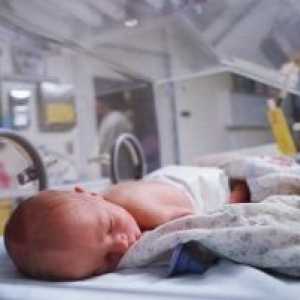 Dijafragmalna kila mana novorođenčadi