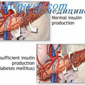 Učinak inzulina na metabolizam ugljikohidrata. Razmjena glukoze inzulina