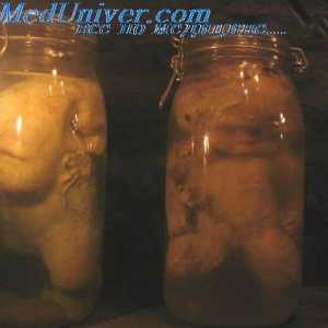 Formiranje embrija suočava. Vanjski spolni organ fetusa