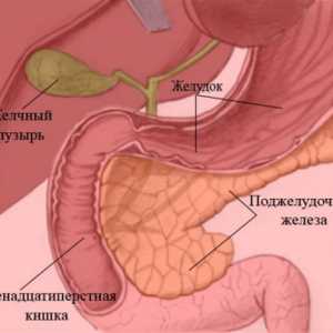 Gastritis i gastroduodenitis: koja je razlika?