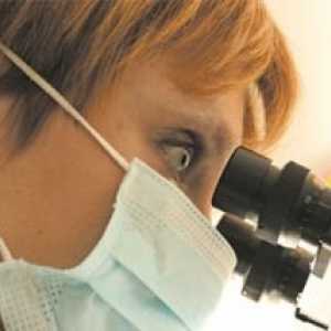 Histopiazmoza: Simptomi, liječenje, dijagnoza