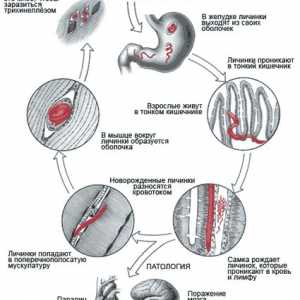 Helminta (crvi) koji žive u ljudskim mišićima, simptome i fotografija